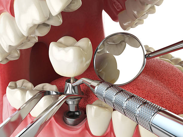 Best Emergency Dental Care for Trauma or Injury in Isle Of Hope, GA